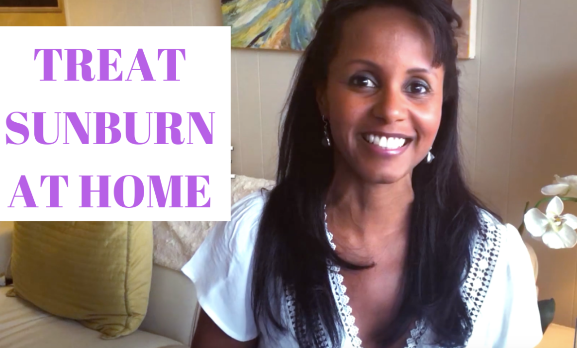 Treat Sunburn at Home | Jovanka Ciares