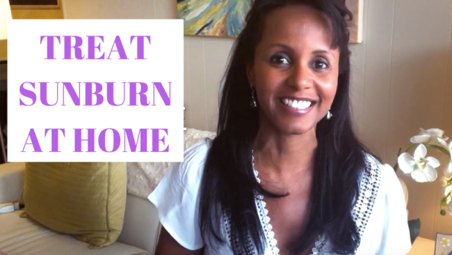 Treat Sunburn at Home | Jovanka Ciares